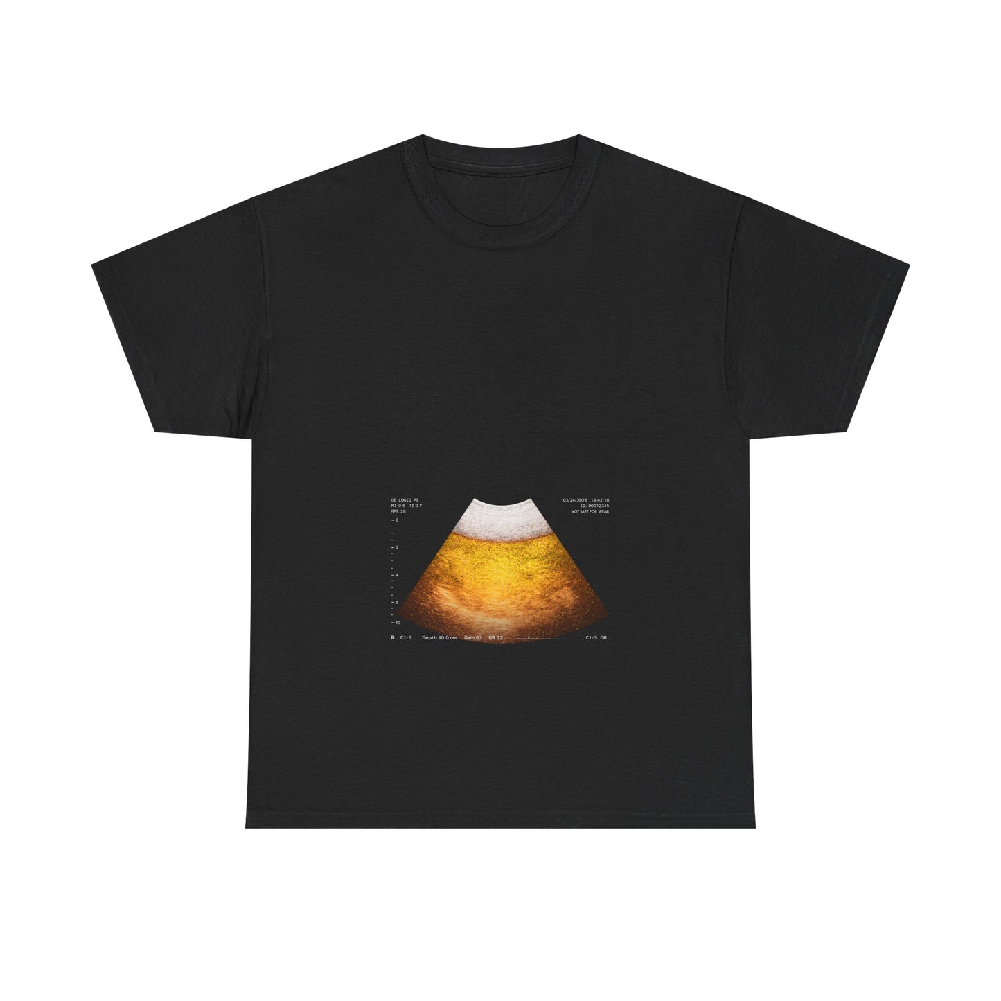 Beer Ultrasound 2 T-Shirt!