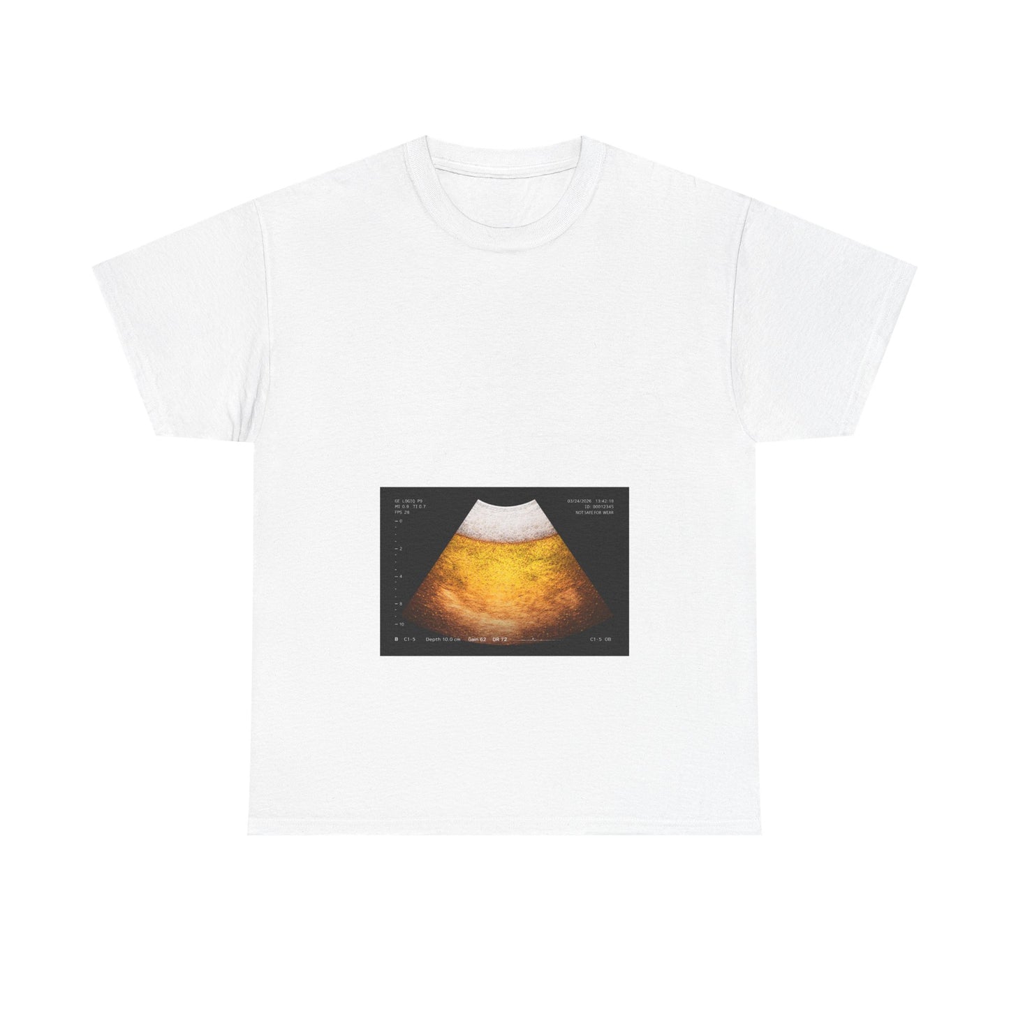 Beer Ultrasound 2 T-Shirt!