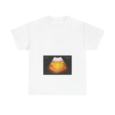 Beer Ultrasound 2 T-Shirt!