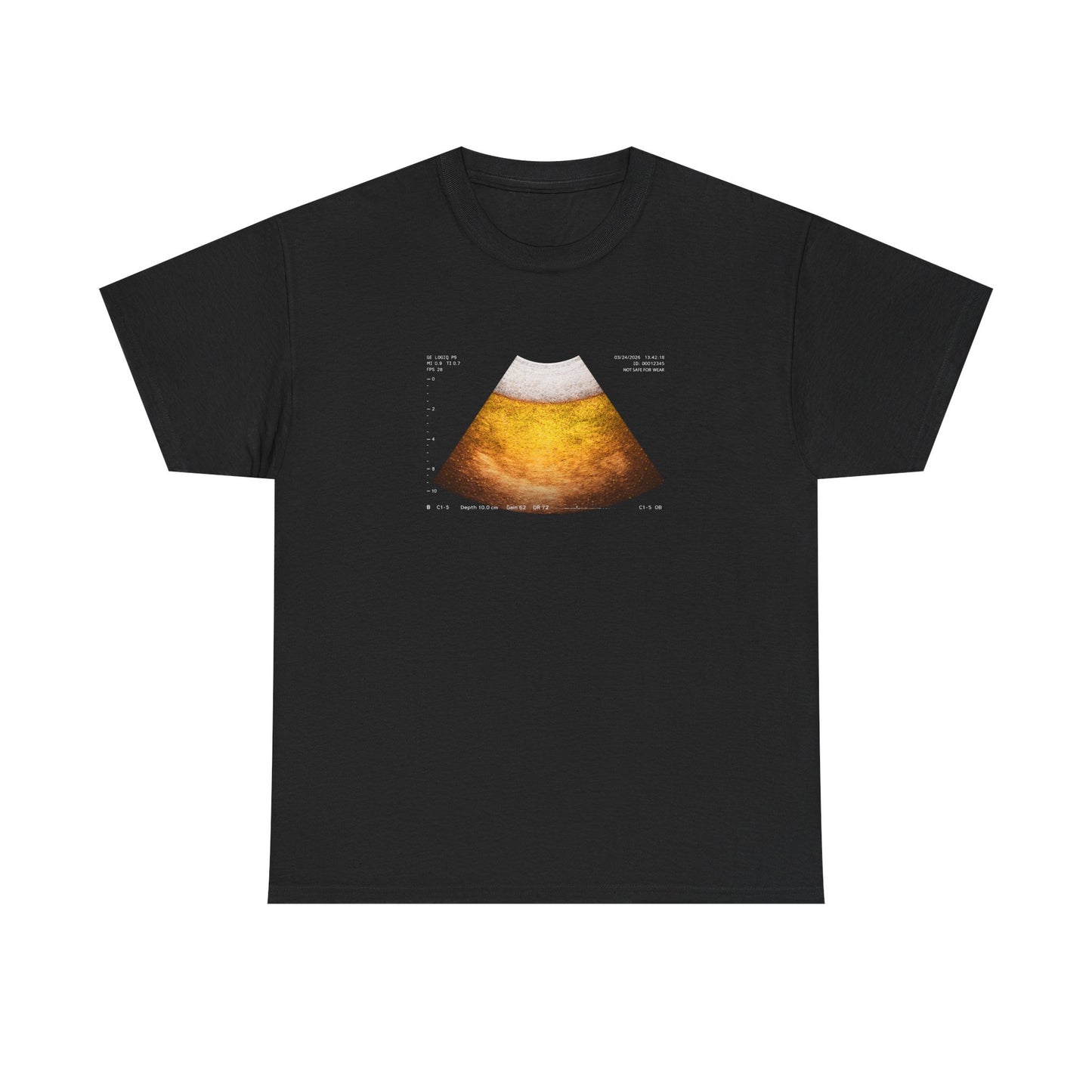 Beer Ultrasound T-Shirt!
