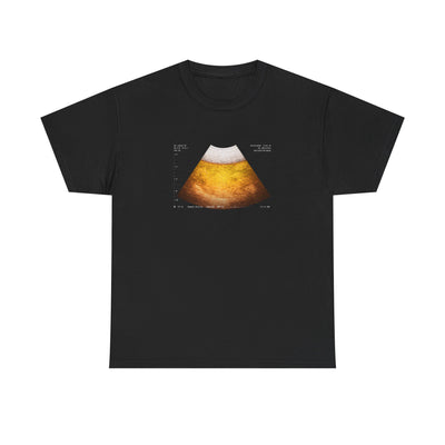 Beer Ultrasound T-Shirt!