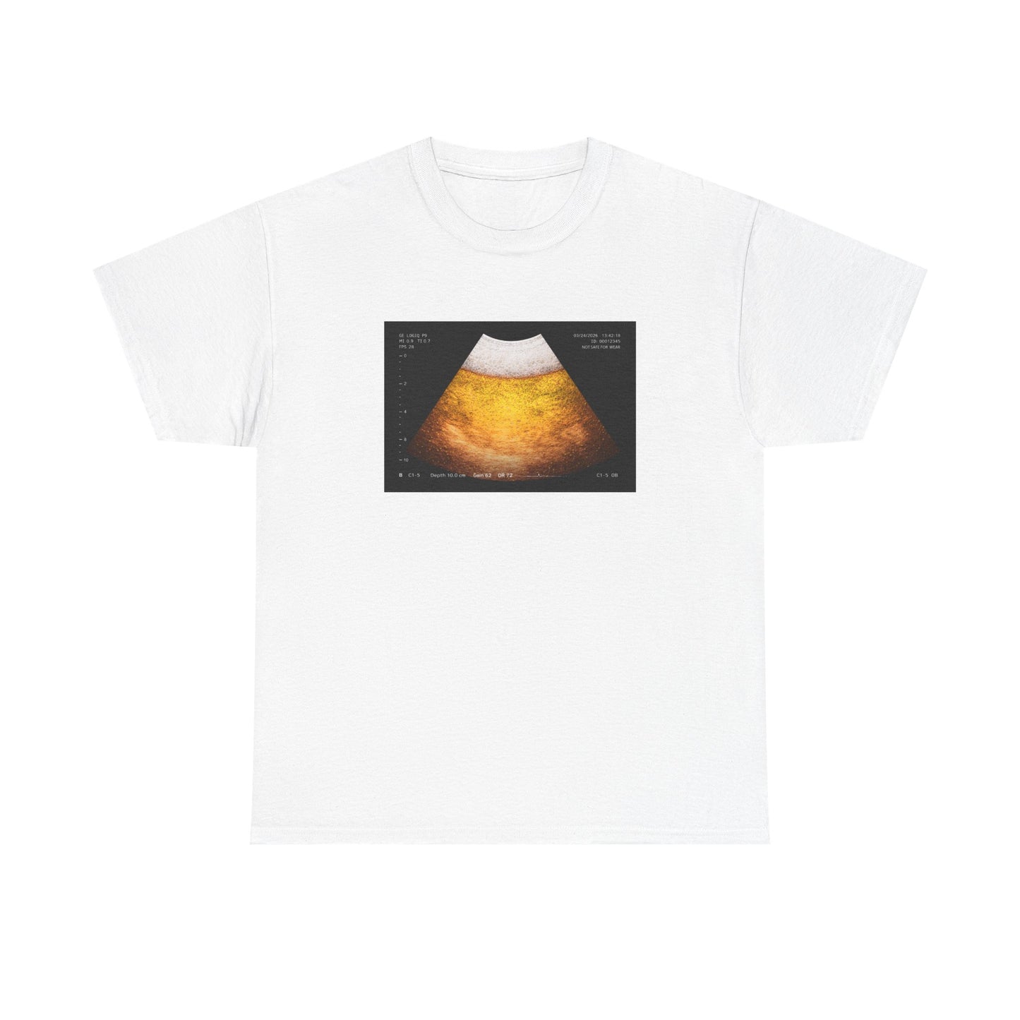 Beer Ultrasound T-Shirt!