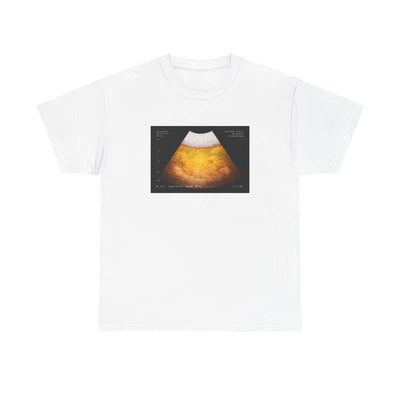 Beer Ultrasound T-Shirt!